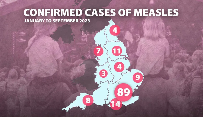 Число случаев кори в Англии удвоилось за год и достигло 30-летнего максимума, что отражено на интерактивной карте