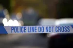 Причины смерти 28-летней матери, скончавшейся через несколько часов после операции по увеличению ягодиц в Майами