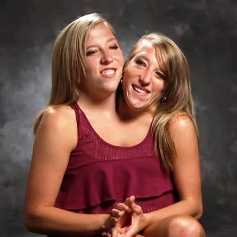 Сестры-близнецы Эбби и Бриттани Хенсел раскрывают удивительные детали своей жизни, которые заставят вас потерять дар речи