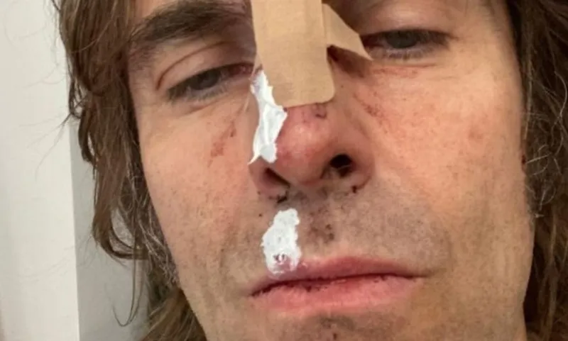 Лиам Галлахер делится редким солнечным селфи во время отдыха на юге Франции