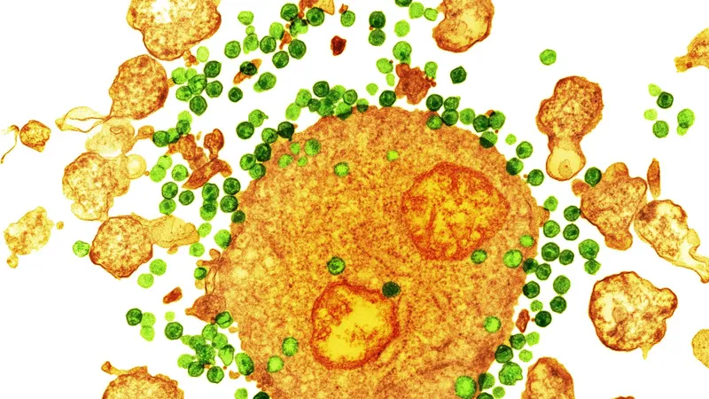 Ученые нашли способ уничтожить вирус, вызывающий СПИД, что может стать прорывом в лечении ВИЧ-инфекции